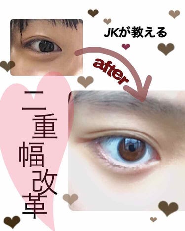 皆さんこんばんは♥︎

今回は私の二重事情についてお教えします🥺
もともと二重ではあるものの、最近まぶたが重く、奥二重気味だったので二重幅を広くしたい！と思い実践したところ、見事成功しました😤

商品は