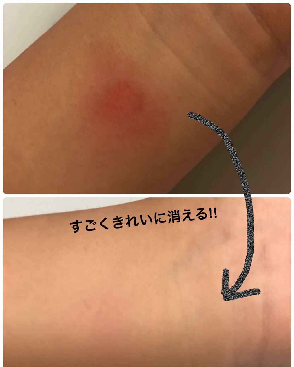 カバーパーフェクション チップコンシーラー/the SAEM/リキッドコンシーラーを使ったクチコミ（2枚目）