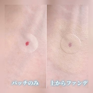 金冠堂 極薄透明パッチ nikipa!のクチコミ「上からメイクOK！極薄ニキビパッチ🩵が優秀✨️ニキビを守って保湿ケア💙


【使った商品】
金.....」（3枚目）