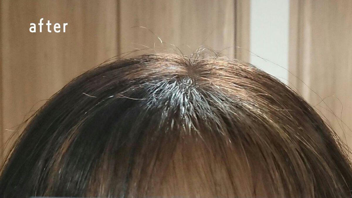 を使ったクチコミ（3枚目）