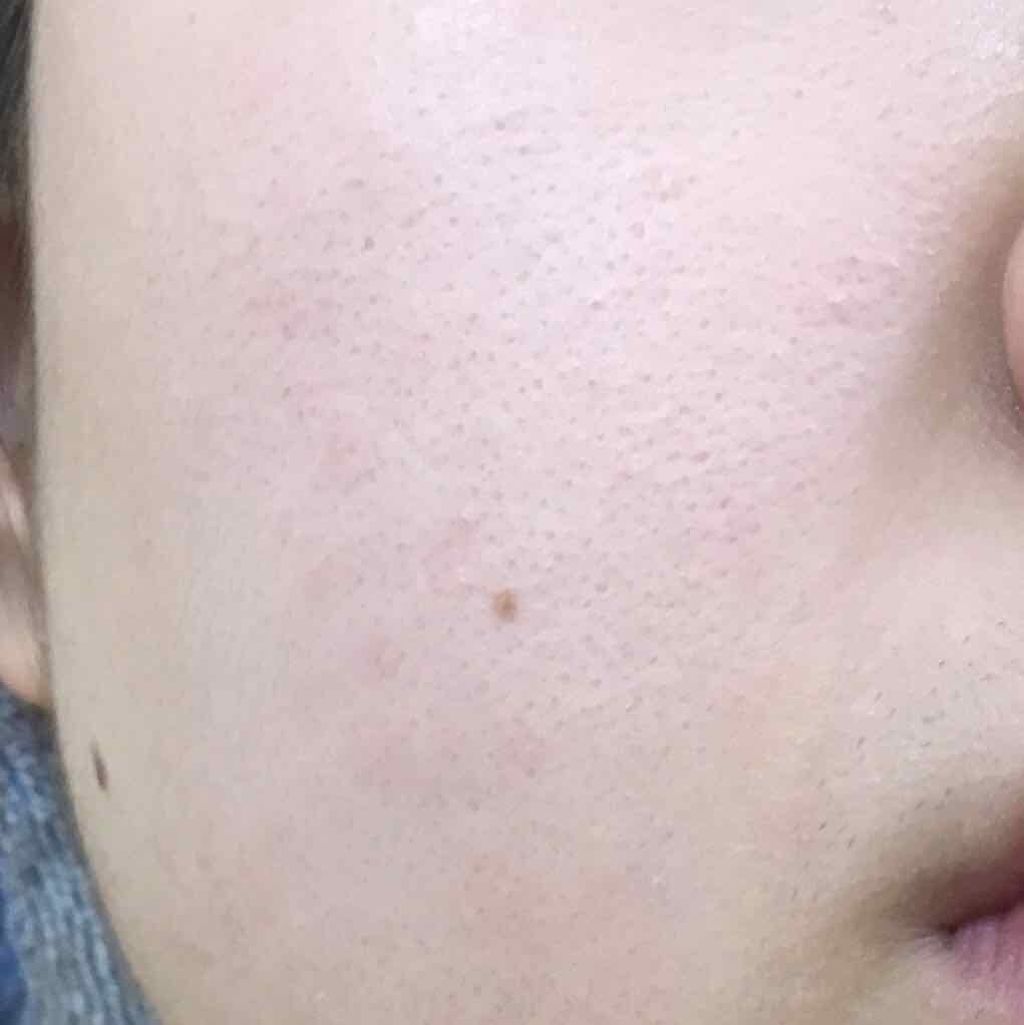 ハトムギ化粧水(ナチュリエ スキンコンディショナー R )/ナチュリエ/化粧水を使ったクチコミ（2枚目）