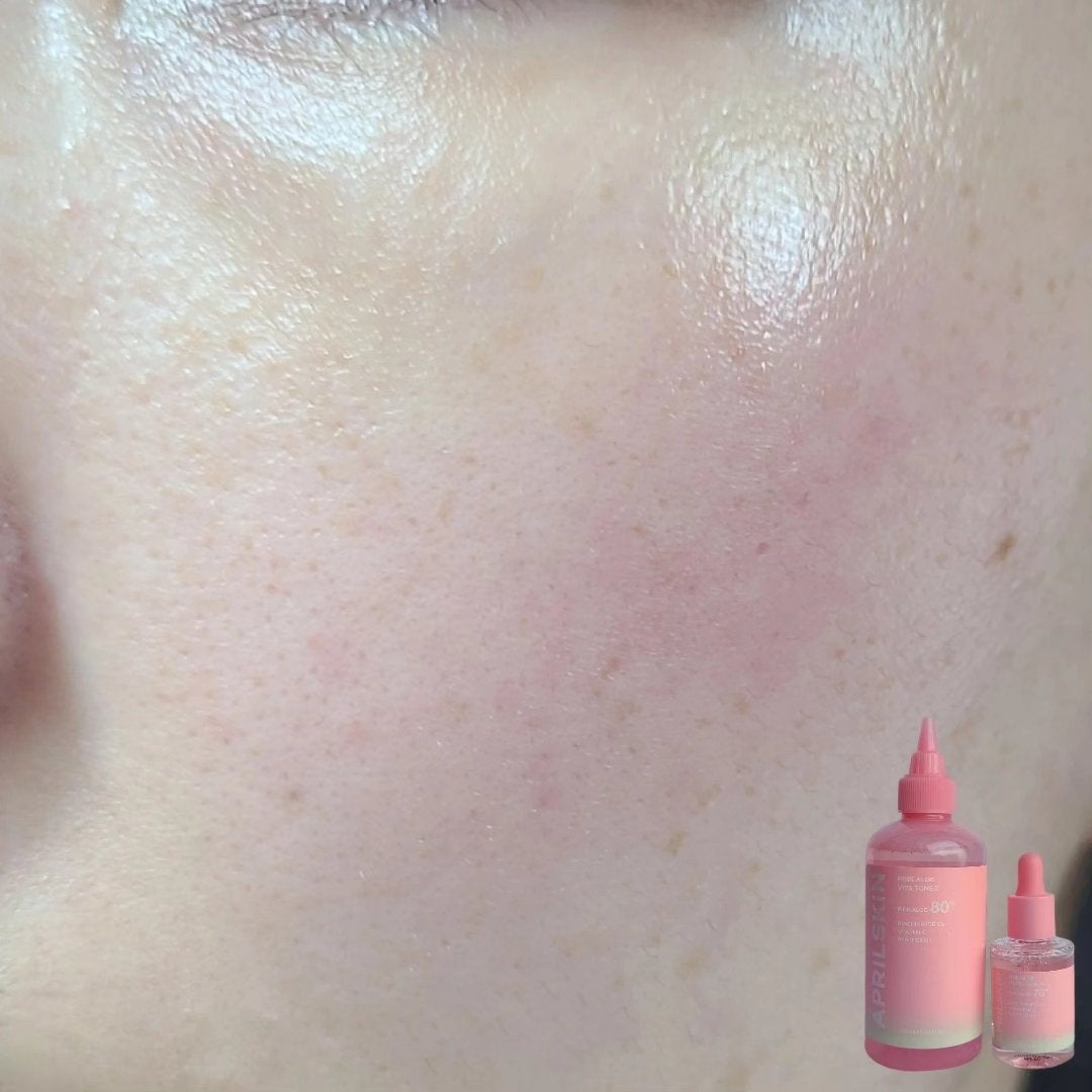 ピンクアロエビタトナー/APRILSKIN/化粧水を使ったクチコミ(5枚目)