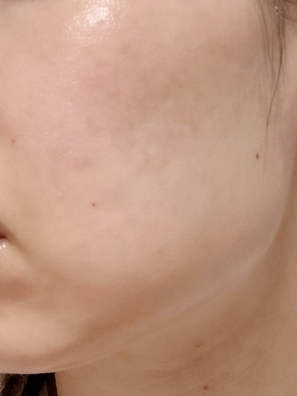 Dior カプチュール ユース インテンス R オイルのクチコミ「乾燥、毛穴対策に❣️
なんか、見た目は白くなったような。笑
もったいなくてなかなか使っていな.....」(3枚目)