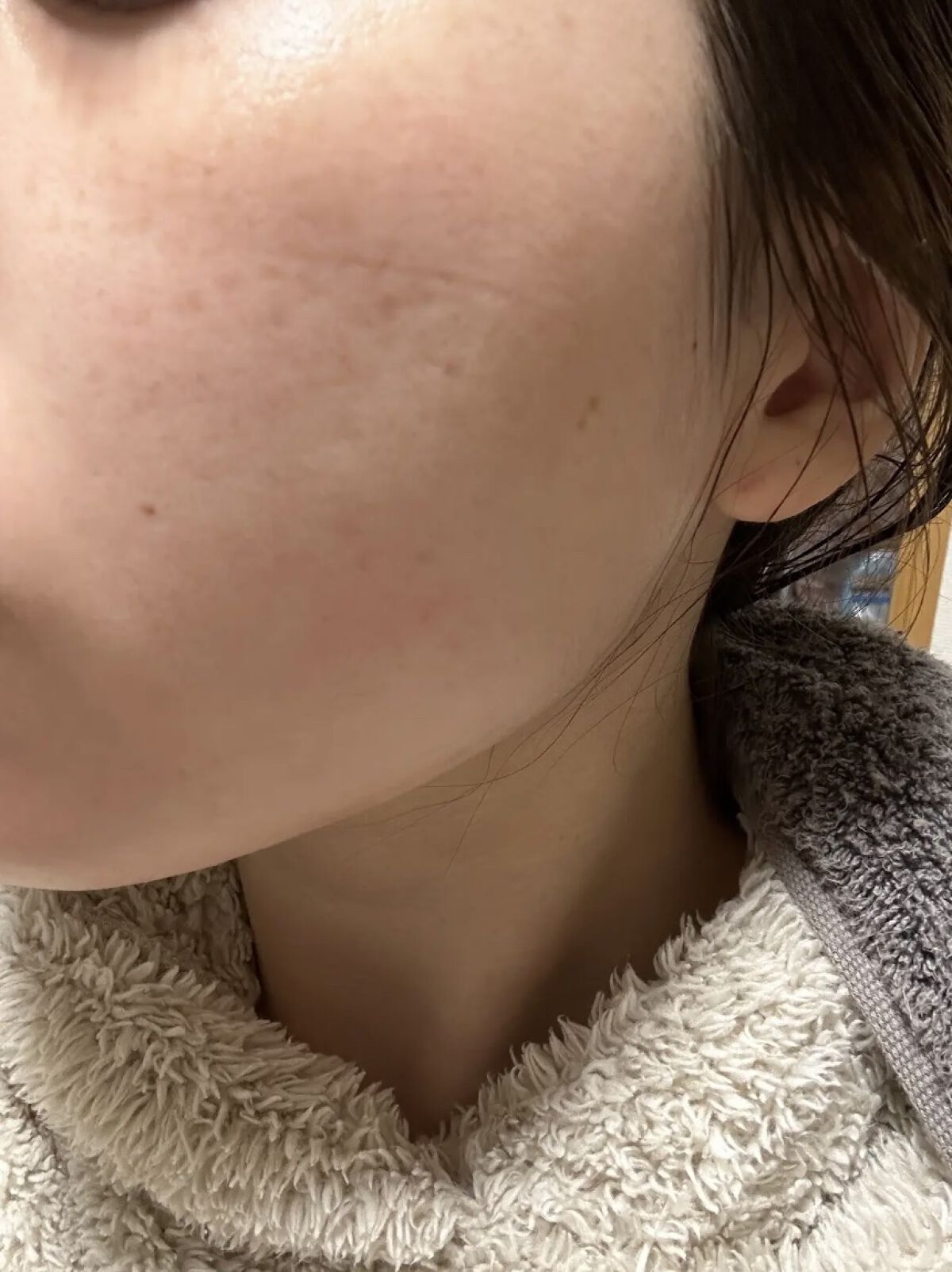 バオバブスージングモイスチャーセラム/MEDIHEAL/美容液を使ったクチコミ（3枚目）