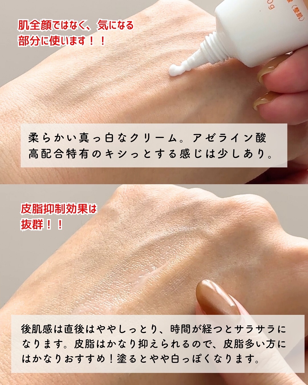 KIWAMI AZスキンクリーム/武内製薬/フェイスクリームを使ったクチコミ（3枚目）