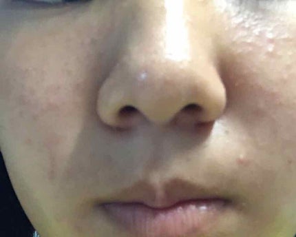 ハトムギ化粧水(ナチュリエ スキンコンディショナー R )/ナチュリエ/化粧水を使ったクチコミ(4枚目)