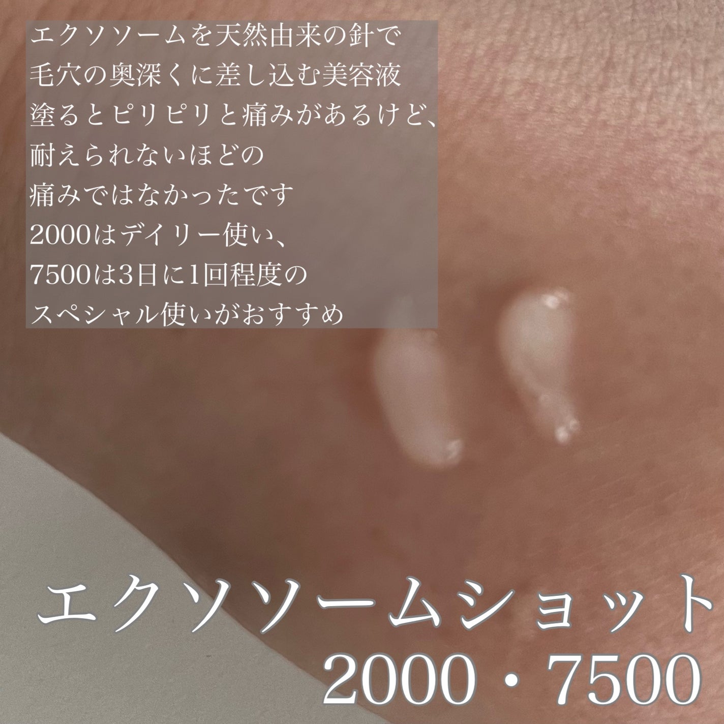 ゼロ毛穴パッド 2.0/MEDICUBE/トナーパッドを使ったクチコミ(4枚目)