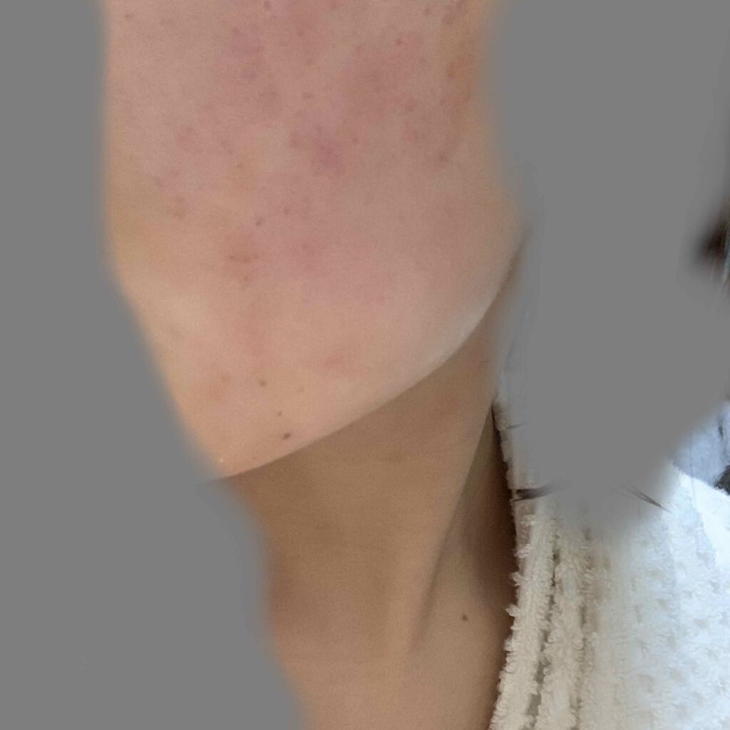 白潤 薬用美白化粧水(しっとりタイプ)/肌ラボ/化粧水を使ったクチコミ(2枚目)