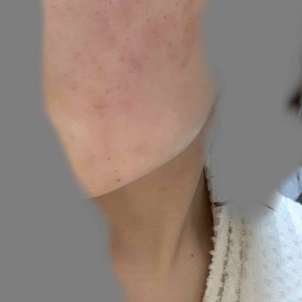 白潤 薬用美白化粧水(しっとりタイプ)/肌ラボ/化粧水を使ったクチコミ(2枚目)