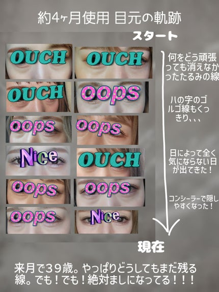 Cemenrete Calcium Intense Cream/Dr.Melaxin/フェイスクリームを使ったクチコミ(5枚目)