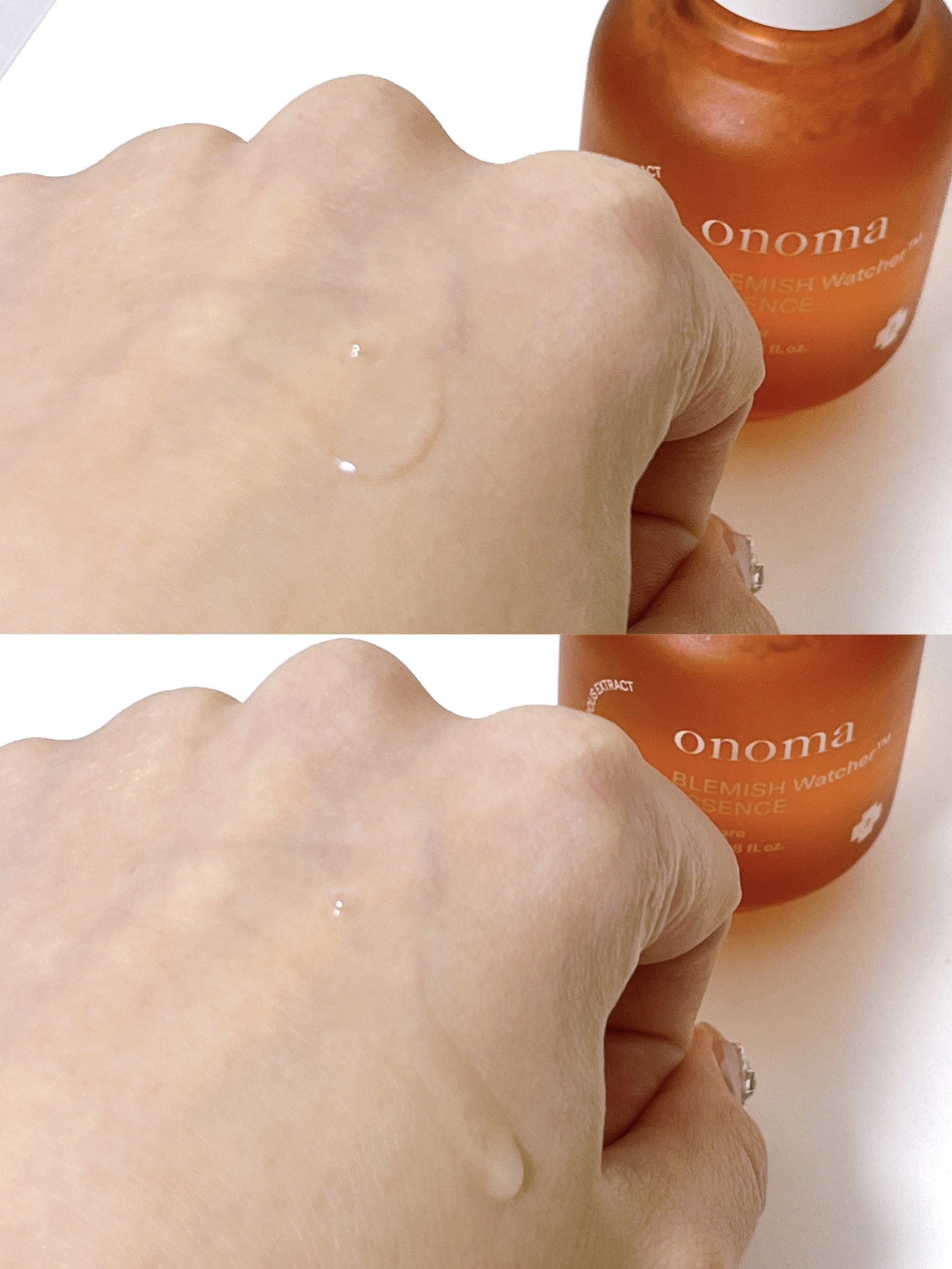 ブレミッシュウォッチャーエッセンス/onoma/美容液を使ったクチコミ（3枚目）