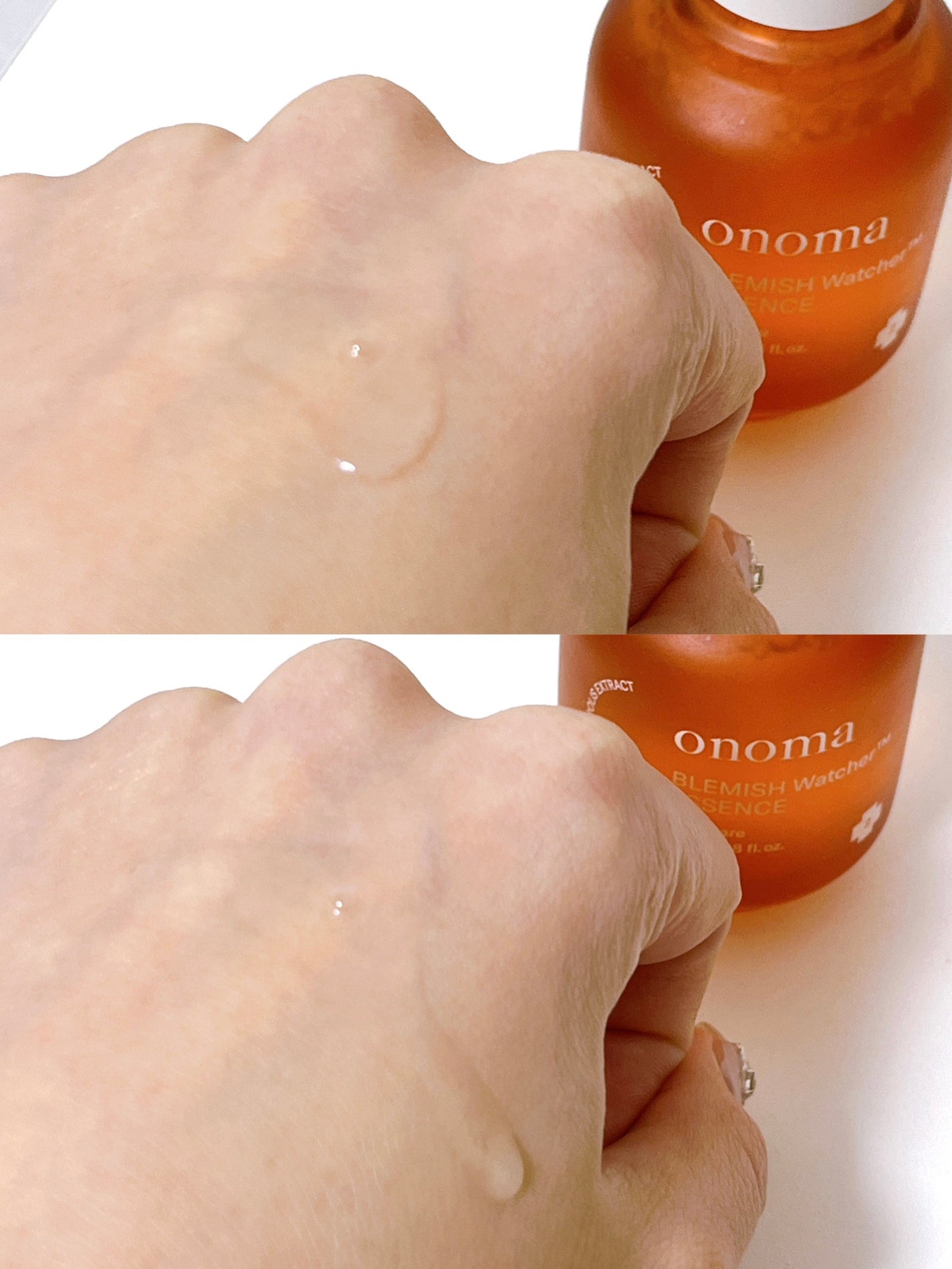 ブレミッシュウォッチャーエッセンス/onoma/美容液を使ったクチコミ(3枚目)