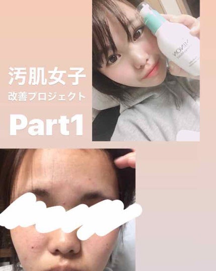 ミノン アミノモイスト 薬用アクネケア ローション/ミノン/化粧水を使ったクチコミ(1枚目)