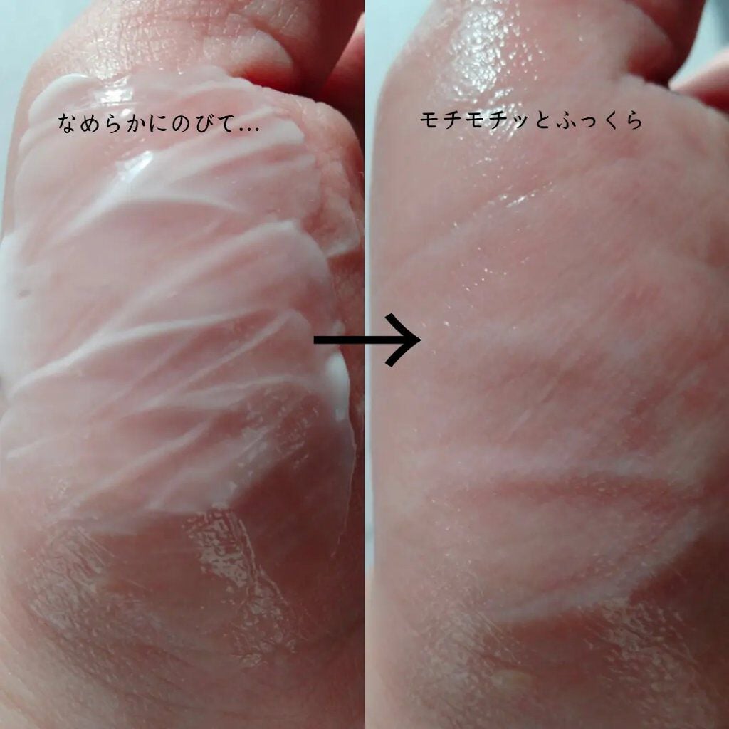 フルフィットプロポリスライトクリーム/COSRX/フェイスクリームを使ったクチコミ(4枚目)