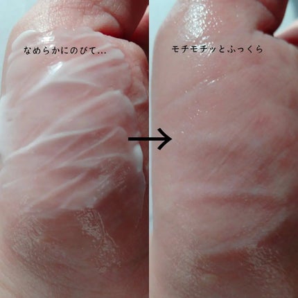 フルフィットプロポリスライトクリーム/COSRX/フェイスクリームを使ったクチコミ(4枚目)