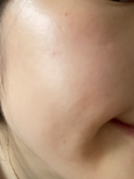 角質スッキリ毛穴パック /HANYUL(ハンユル)/洗い流すパック・マスクを使ったクチコミ(3枚目)