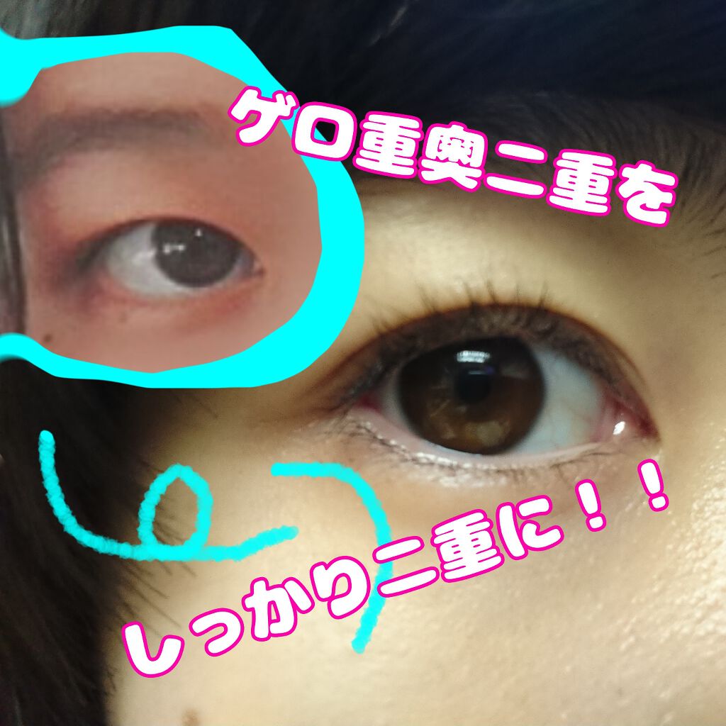 のびーるアイテープ（絆創膏タイプ、レギュラー）/DAISO/二重まぶた用アイテムを使ったクチコミ（1枚目）