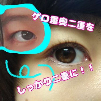 のびーるアイテープ(絆創膏タイプ、レギュラー)/DAISO/二重まぶた用アイテムを使ったクチコミ(1枚目)