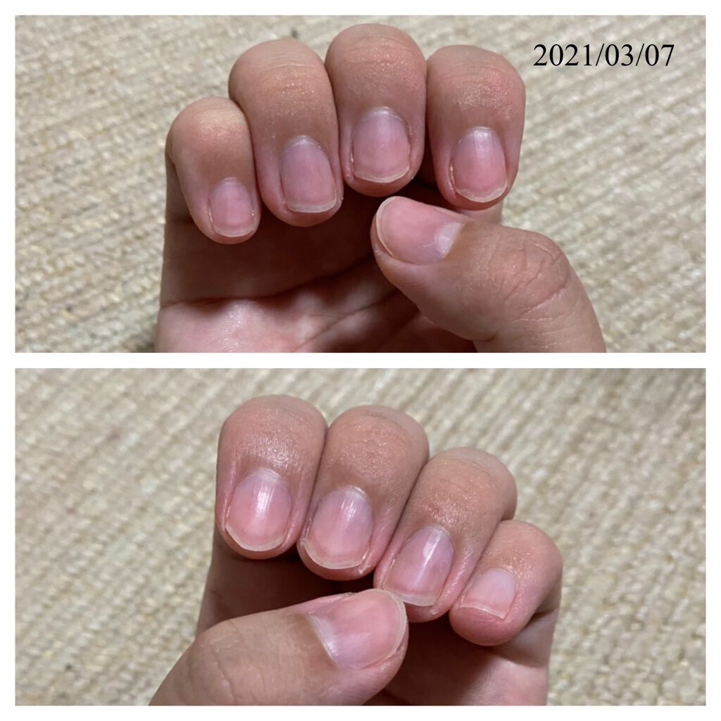 シェイクネイルケアオイル/スキューズミー/ネイルオイル・トリートメントを使ったクチコミ（3枚目）