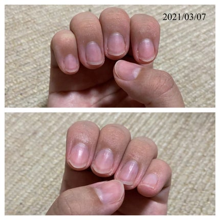 エテュセ クイックケアコート/ettusais/ネイルオイル・トリートメントを使ったクチコミ(3枚目)