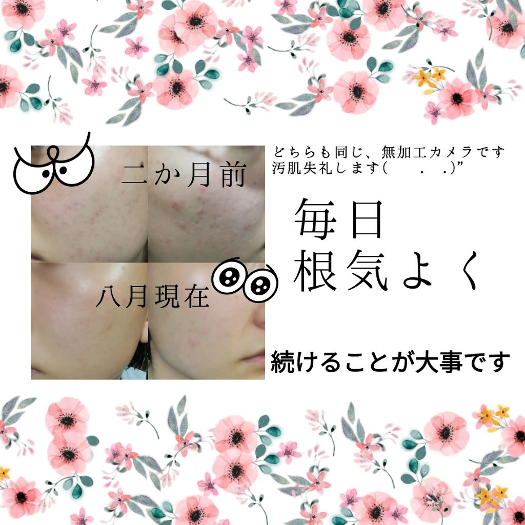 ハトムギ化粧水(ナチュリエ スキンコンディショナー R )/ナチュリエ/化粧水を使ったクチコミ（3枚目）