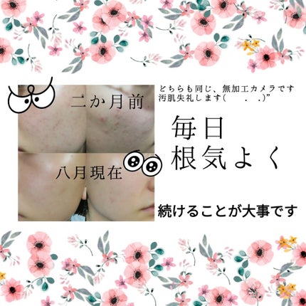 ハトムギ化粧水(ナチュリエ スキンコンディショナー R )/ナチュリエ/化粧水を使ったクチコミ(3枚目)