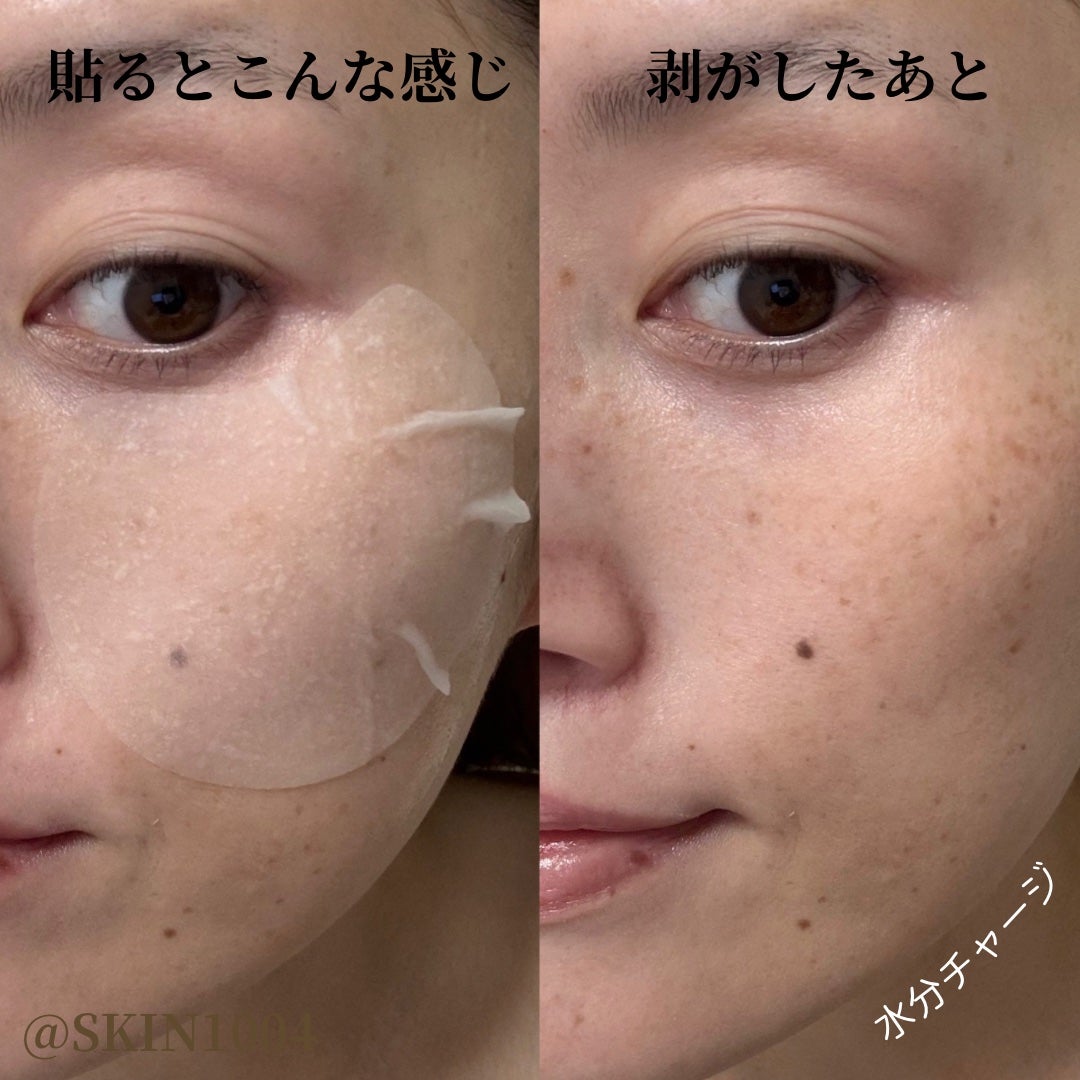 センテラ クイックカーミングパッド/SKIN1004/トナーパッドを使ったクチコミ(6枚目)