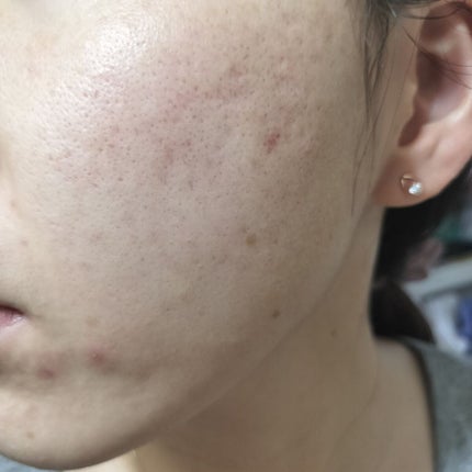 ビオオイル アルガンオイル/Melvita/フェイスオイルを使ったクチコミ(2枚目)