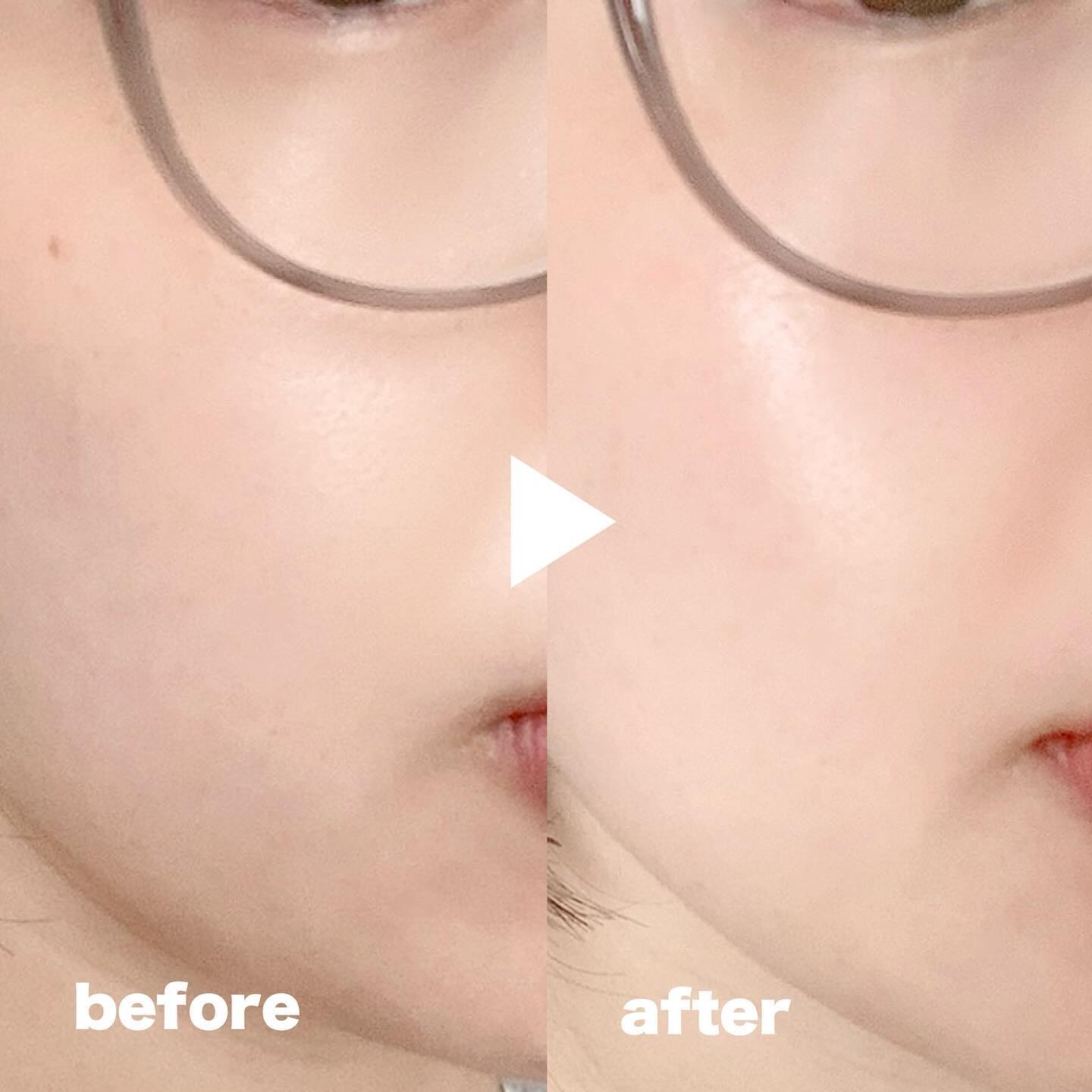 パンテショット675/COSNORI/美容液を使ったクチコミ（3枚目）