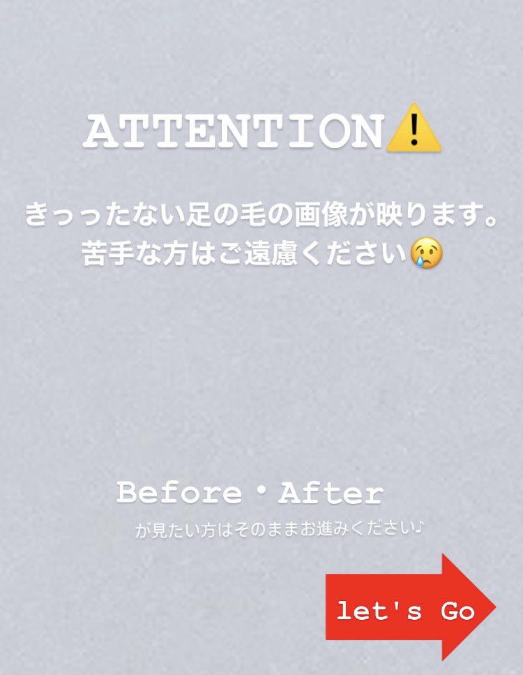 KOIZUMI フェイス＆ボディシェーバー KLC-0720のクチコミ「【ビフォアフ画像⭕️】これから露出が増える時期に☀️カミソリが苦手な方にオススメ💗プチプラ電動.....」（2枚目）