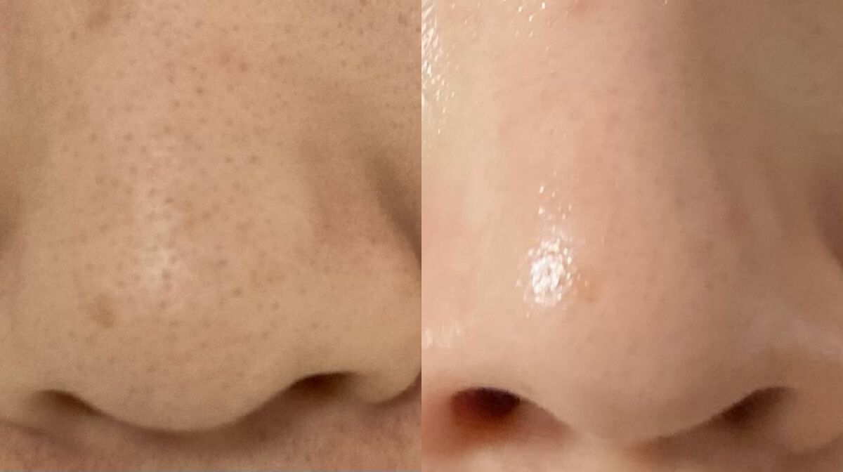 おうちdeエステ 肌をなめらかにするマッサージ洗顔ジェル 炭/ビオレ/その他洗顔料を使ったクチコミ（1枚目）