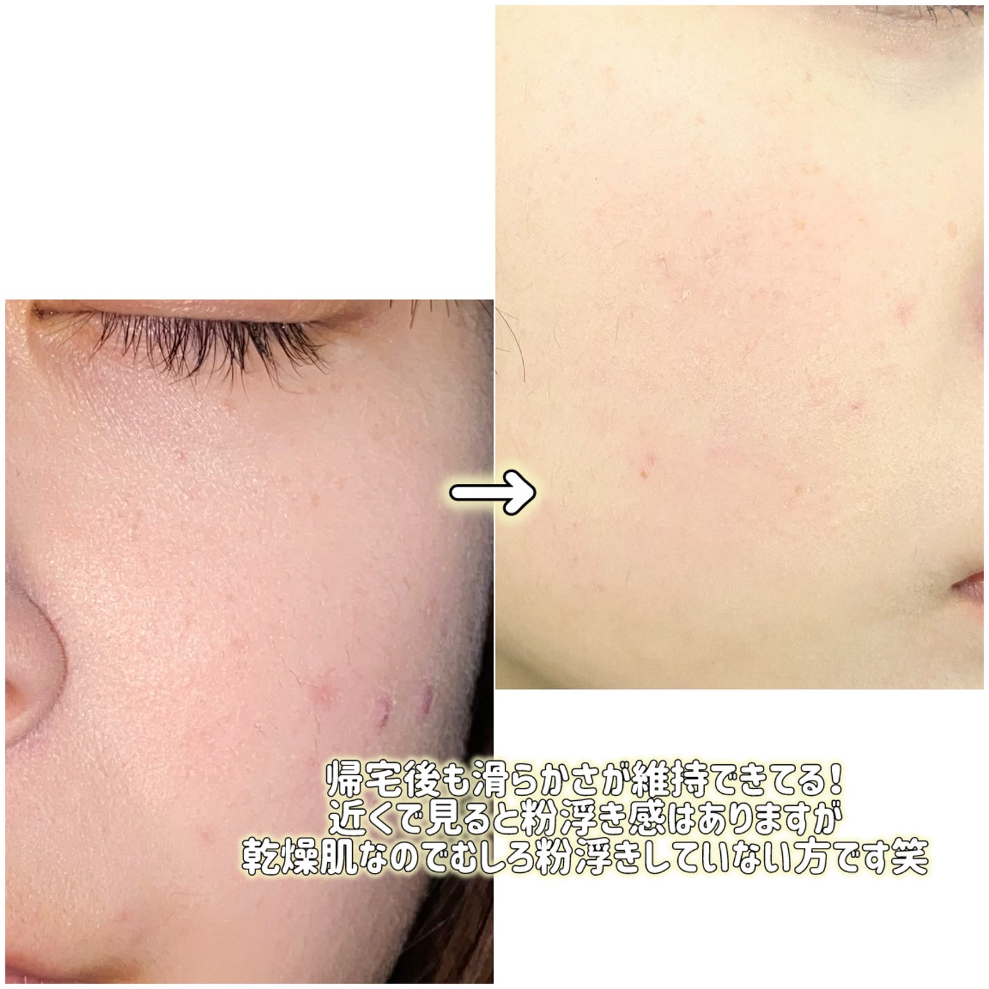 フィクシングヌードクッション/too cool for school/クッションファンデーションを使ったクチコミ(5枚目)