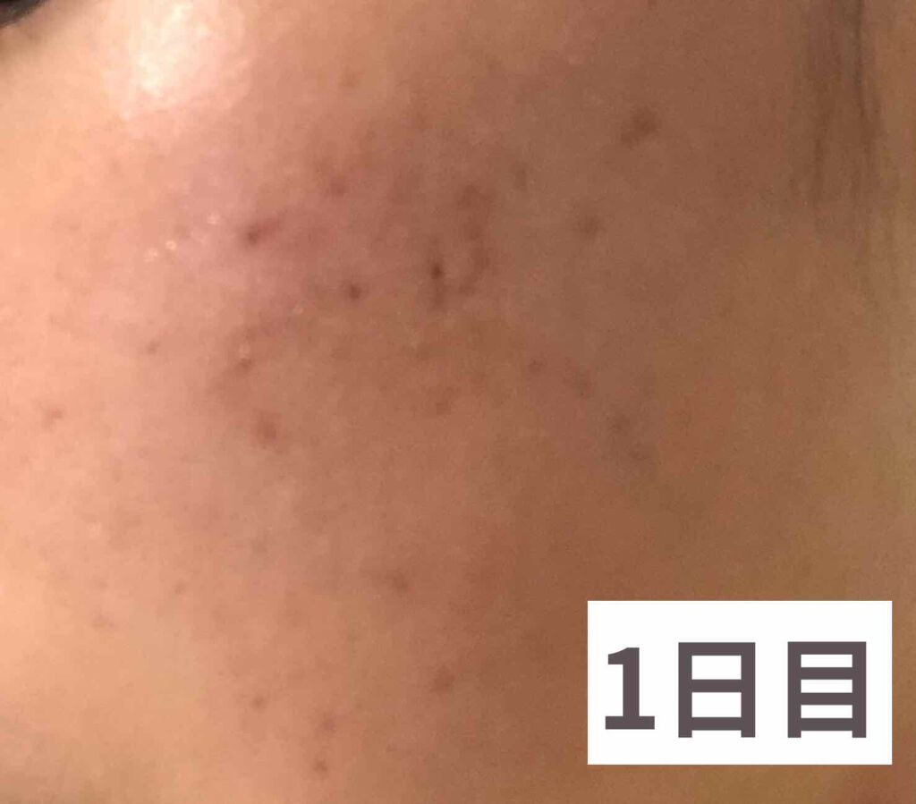 DHC マルチビタミン/DHC/美容サプリメントを使ったクチコミ（3枚目）