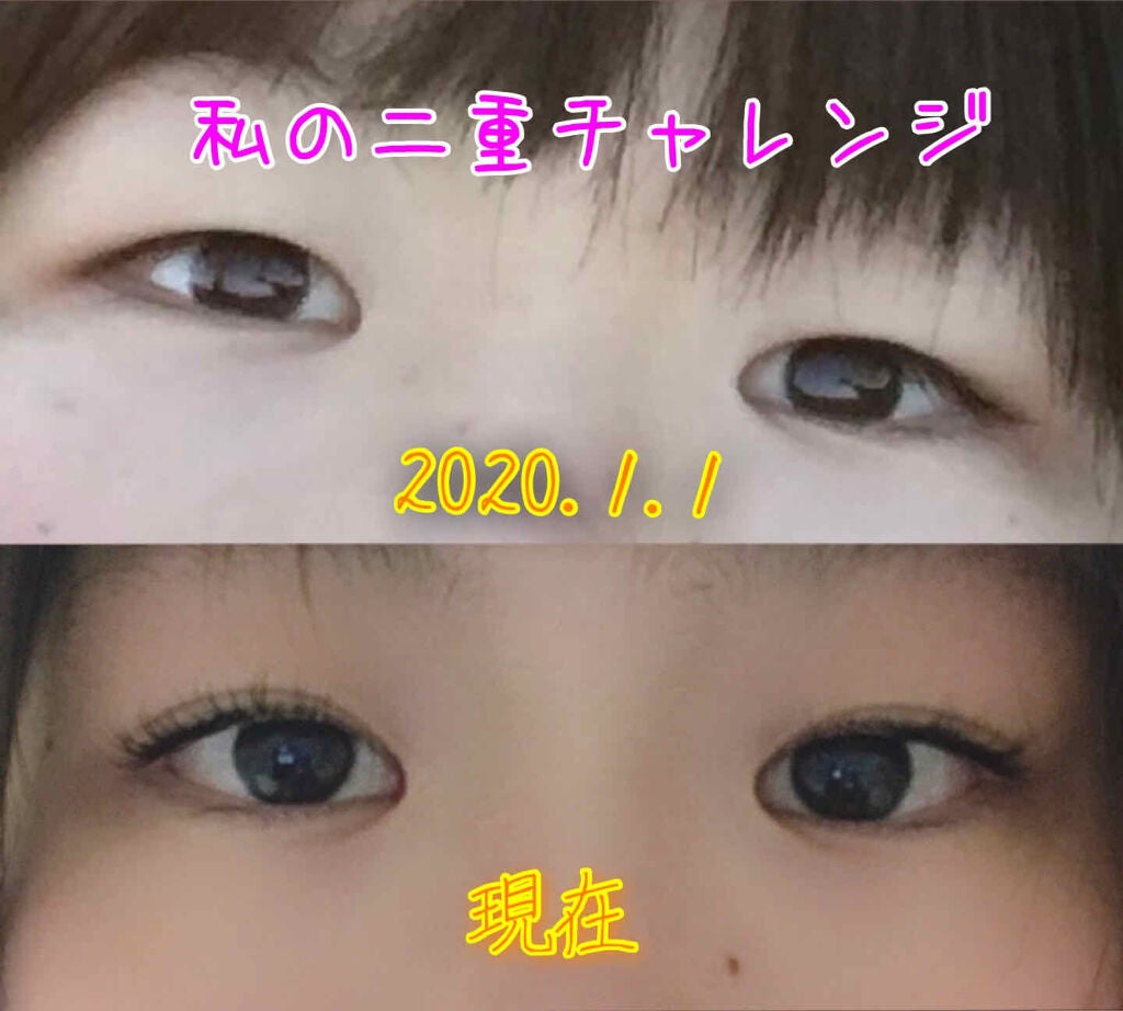 ワンダーアイリッドテープ Extra/D-UP/二重まぶた用アイテムを使ったクチコミ(1枚目)