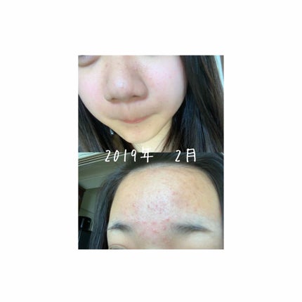 を使ったクチコミ(2枚目)