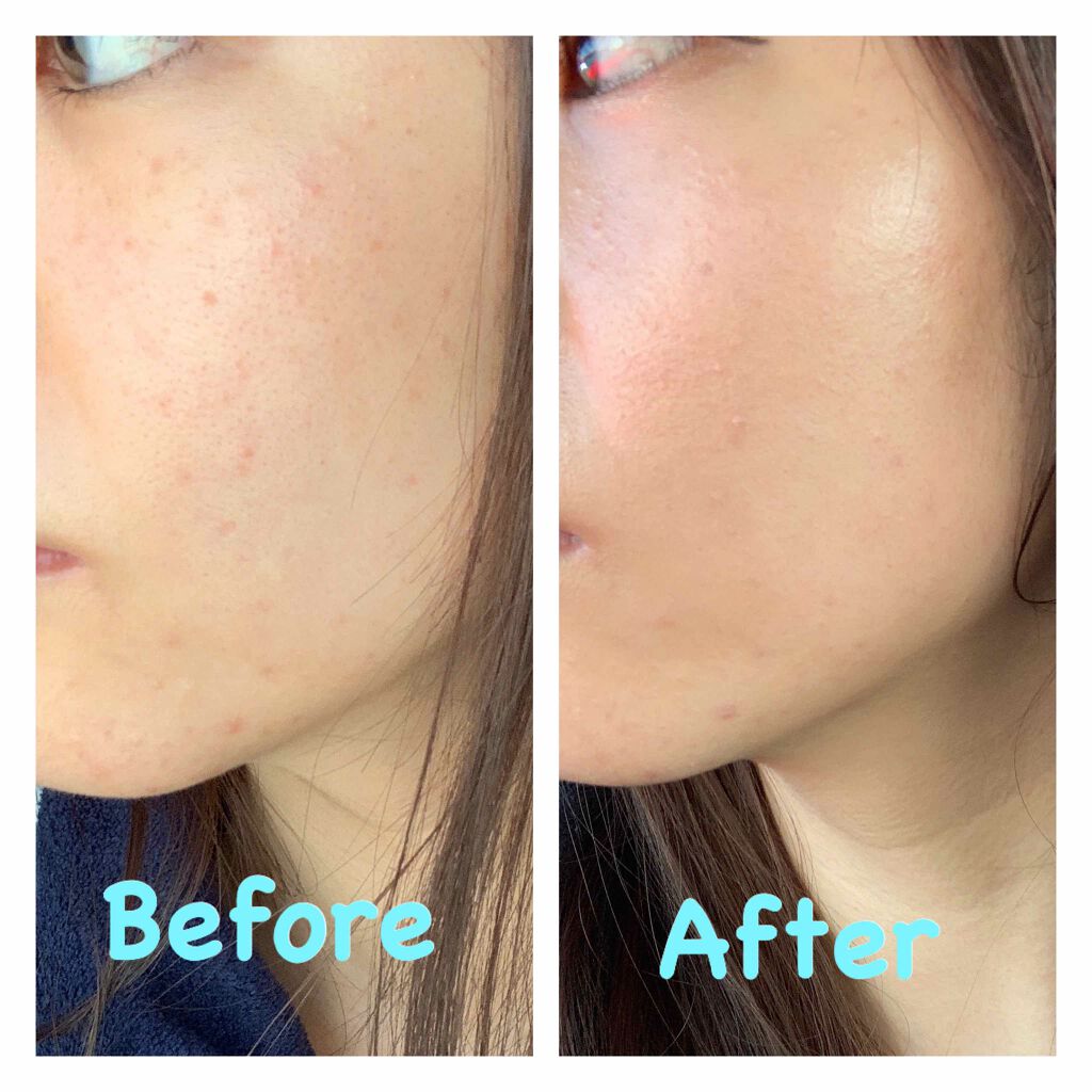 グリーンダーママイルドシカセラムカバークッション/ネイチャーリパブリック/クッションファンデーションを使ったクチコミ(1枚目)