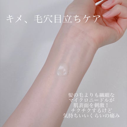 ビディ ニードルエッセンス GG/ビディ/美容液を使ったクチコミ(2枚目)