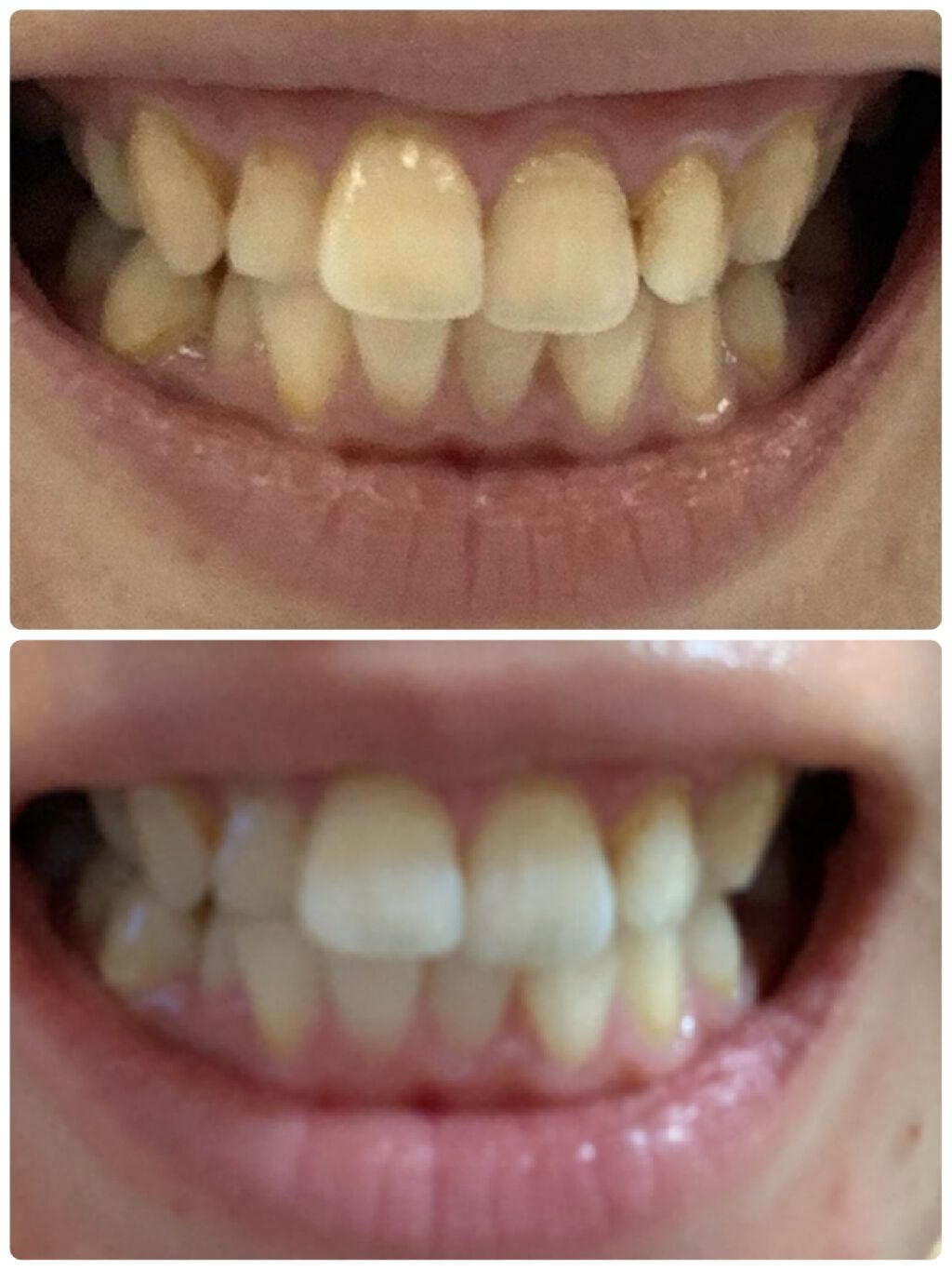 セッチマ はみがきスペシャル/セッチマ/歯磨き粉を使ったクチコミ（2枚目）