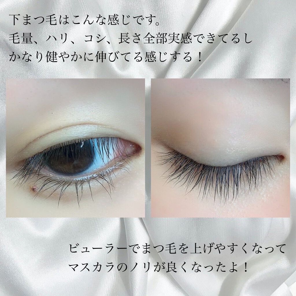 MIRO on LIPS 「【まつ毛育毛の経過!!】かなりの効果で驚きです🥺✨毛量があきら..」(6枚目)