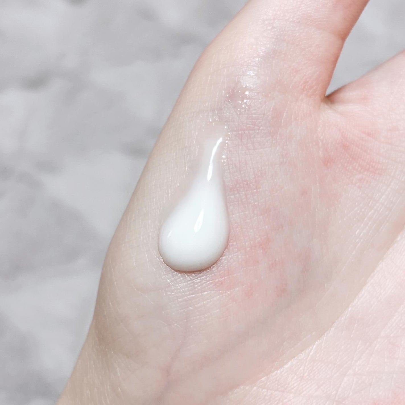 vitoas(ビトアス) マイパーフェクション I しっとり/vitoas/美容液を使ったクチコミ(3枚目)