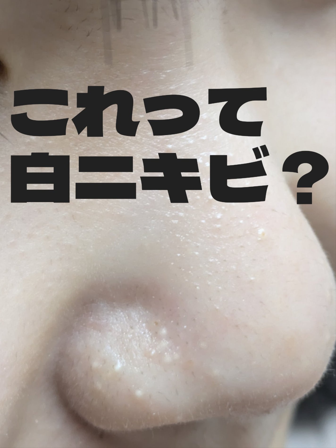 ハトムギ化粧水(ナチュリエ スキンコンディショナー R )/ナチュリエ/化粧水を使ったクチコミ(1枚目)