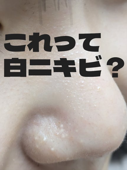 ハトムギ化粧水(ナチュリエ スキンコンディショナー R )/ナチュリエ/化粧水を使ったクチコミ(1枚目)