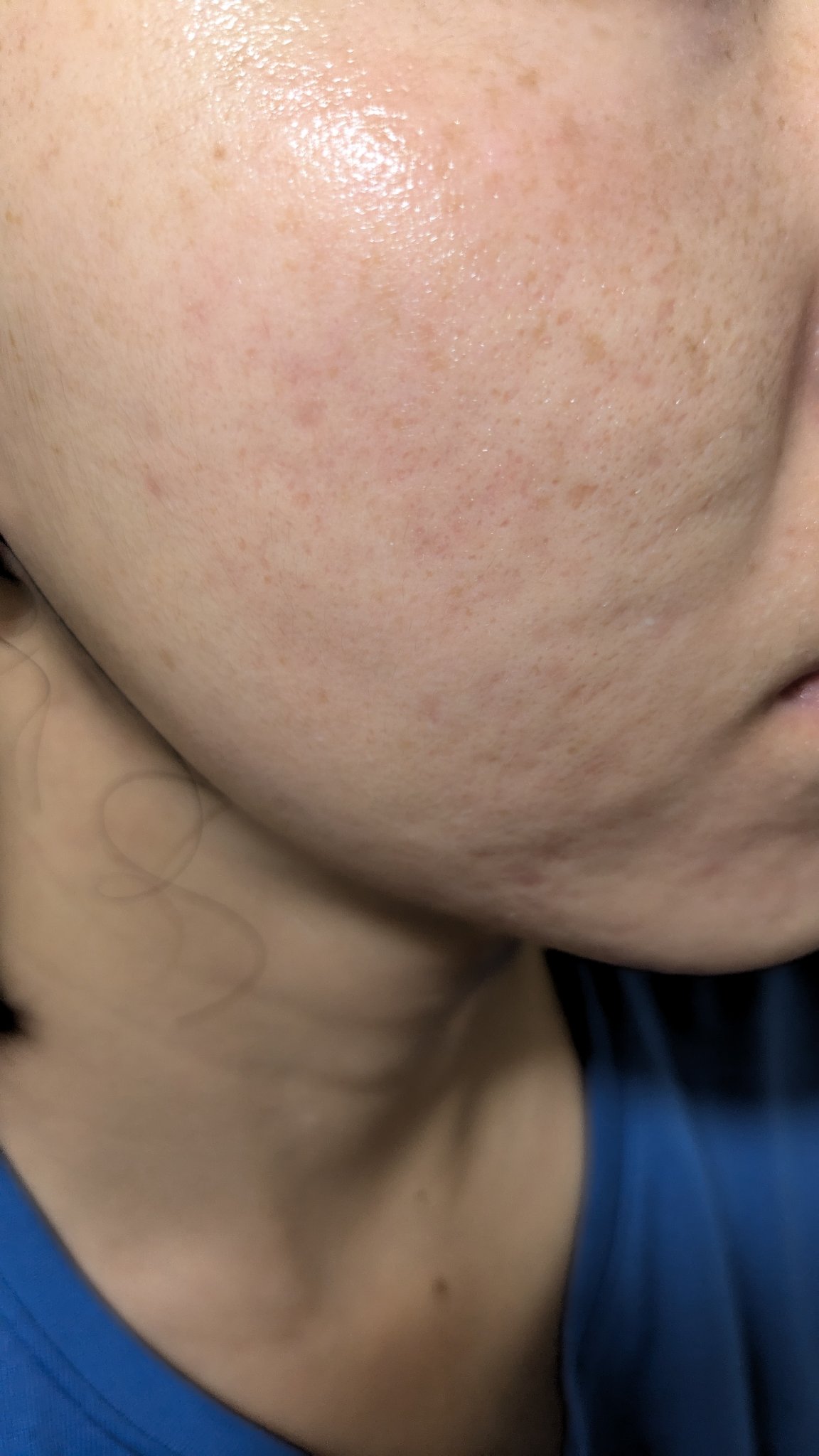 N10+Z1フェイスセラム /The Ordinary/美容液を使ったクチコミ（1枚目）