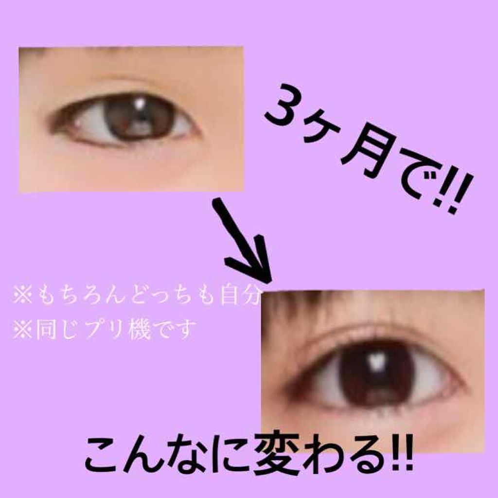 アイトーク/アイトーク/二重まぶた用アイテムを使ったクチコミ(1枚目)