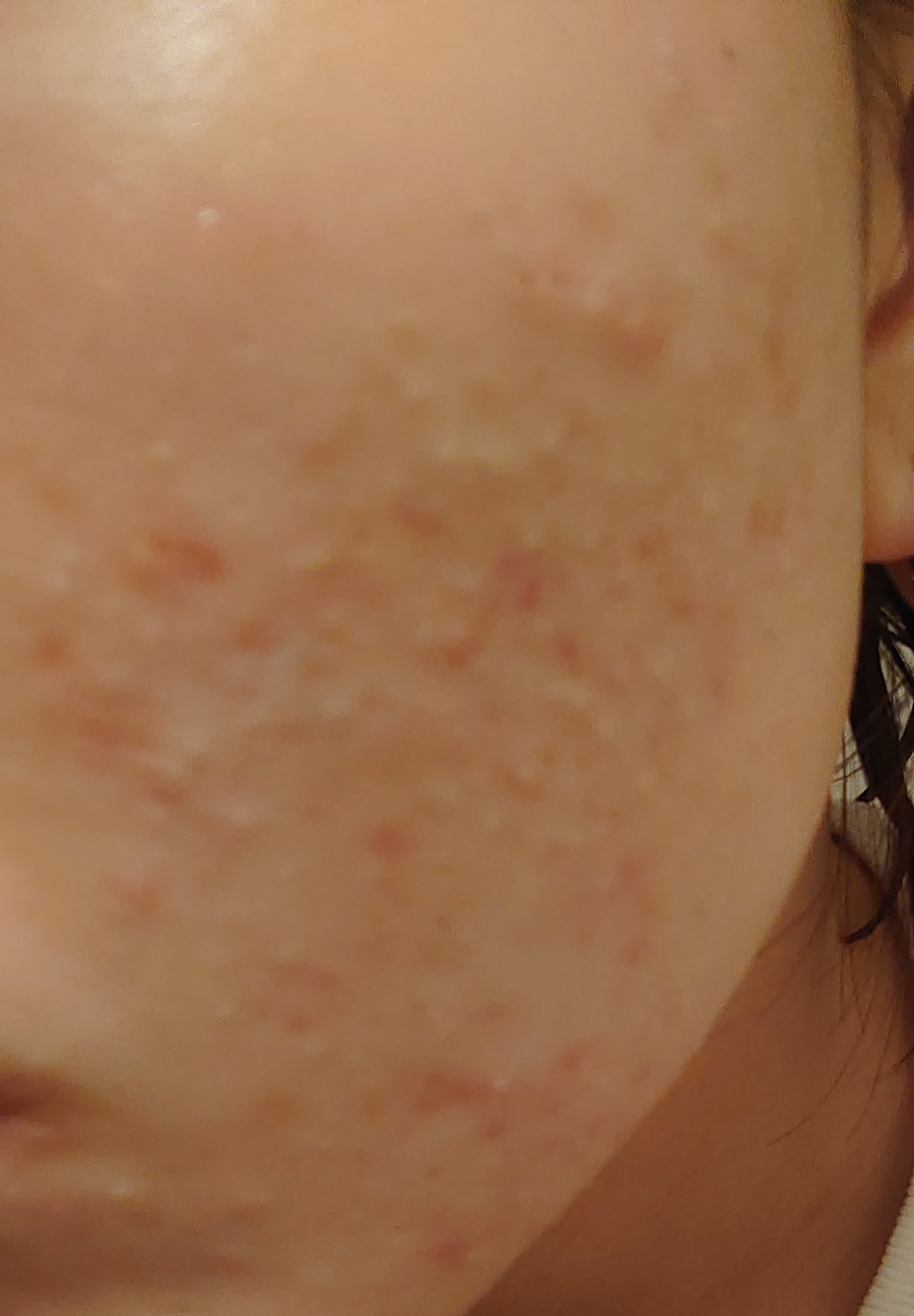 CNPトライアルセット/CNP Laboratory/化粧水を使ったクチコミ（1枚目）