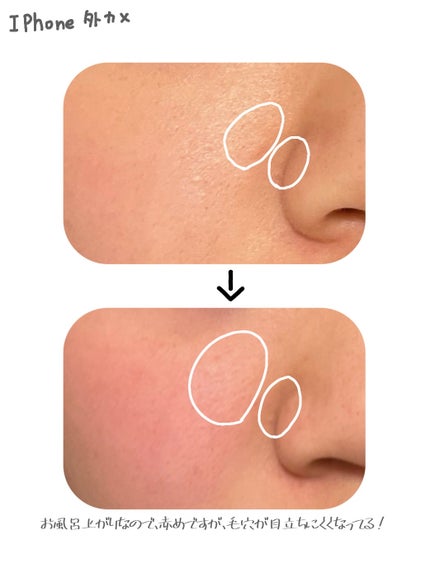 æ¯ç©Žå°çº é
µçŽ ã¯ã¬ã³ãžã³ã°ãªã€ã«/ãœããã£ã¢/ãªã€ã«ã¯ã¬ã³ãžã³ã°ã䜿ã£ãã¯ãã³ãïŒ2æç®ïŒ