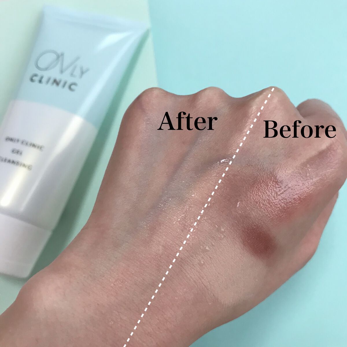 ゲルクレンジング/オンリークリニック/クレンジングジェルを使ったクチコミ(2枚目)