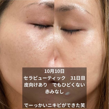 ミラミックス/ZO Skin Health/フェイスクリームを使ったクチコミ(2枚目)