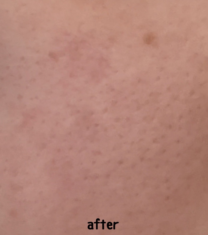 レチノール　シカ　リペア　セラム 【旧】30mL/innisfree/美容液を使ったクチコミ（3枚目）