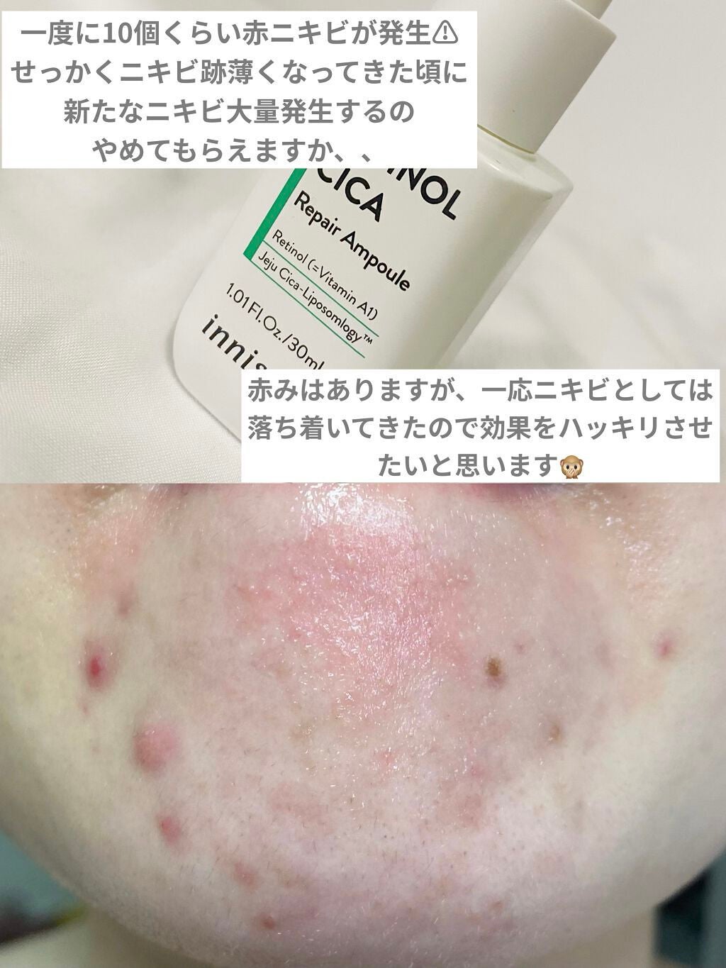 レチノール シカ リペア セラム/innisfree/美容液を使ったクチコミ(2枚目)